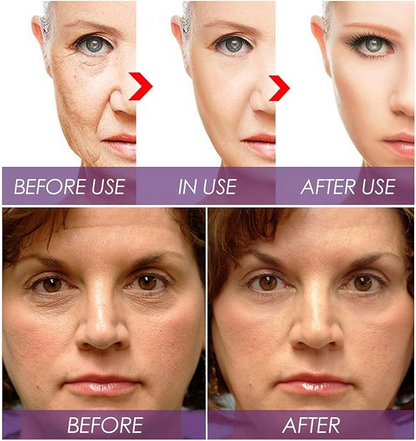 Venature Bakuchiol Retinol Rejuvenation Serum, Retinol & Vitamin for Wrinkles Bakuchiol Retinol Face Serum Korean, Retinol Serum for Wrinkles