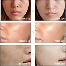 Multifunction Beauty Facial Massager